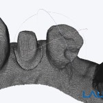 Launca DL-206P